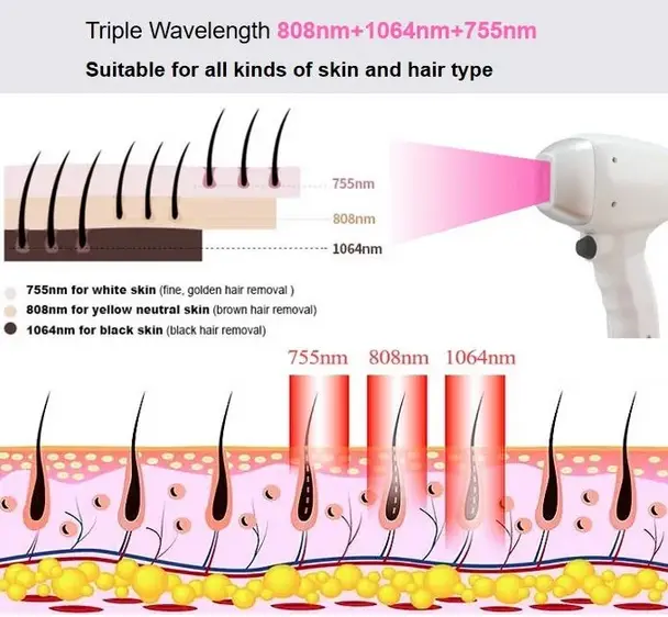 Single Handle Three Wavelength Diode Laser