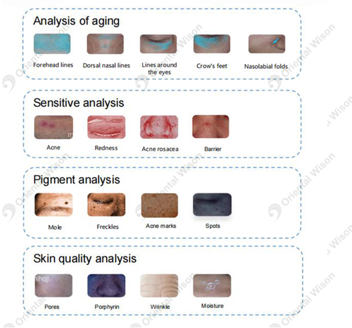 Al Intelligent skin analyzer machine